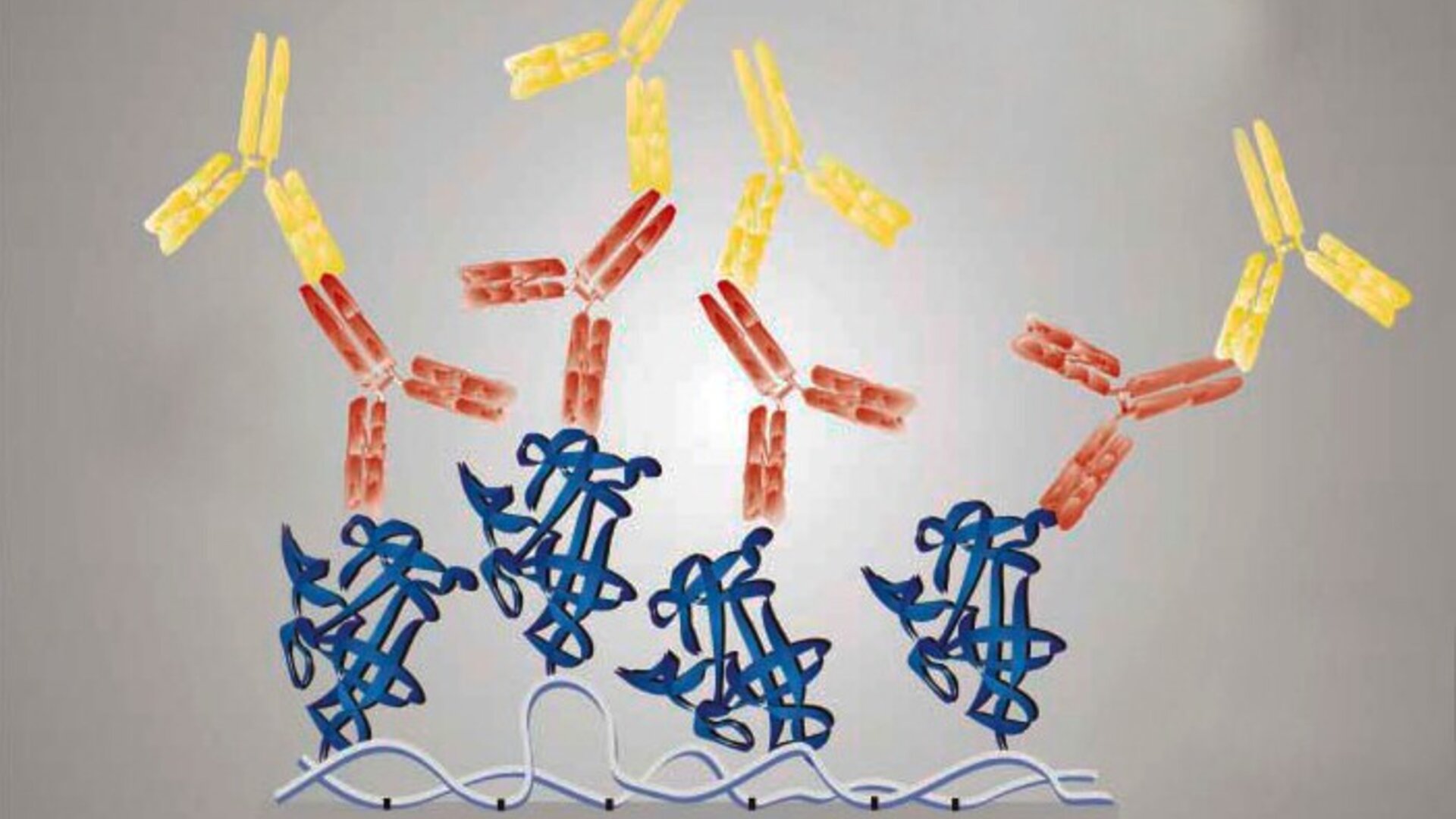 ImmunoCAP ISAC allergy chip: a biochip for molecular allergy diagnostics