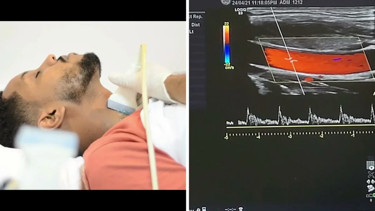 Vascular ultrasound systems for Doppler imaging